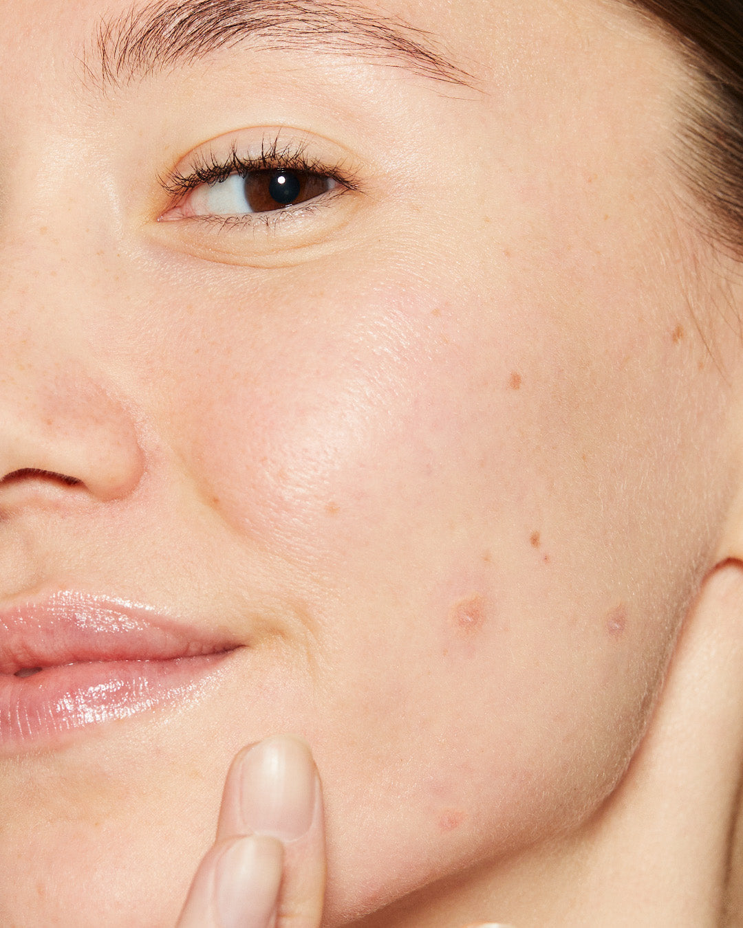 אייג’ ברייט קלירינג סרום