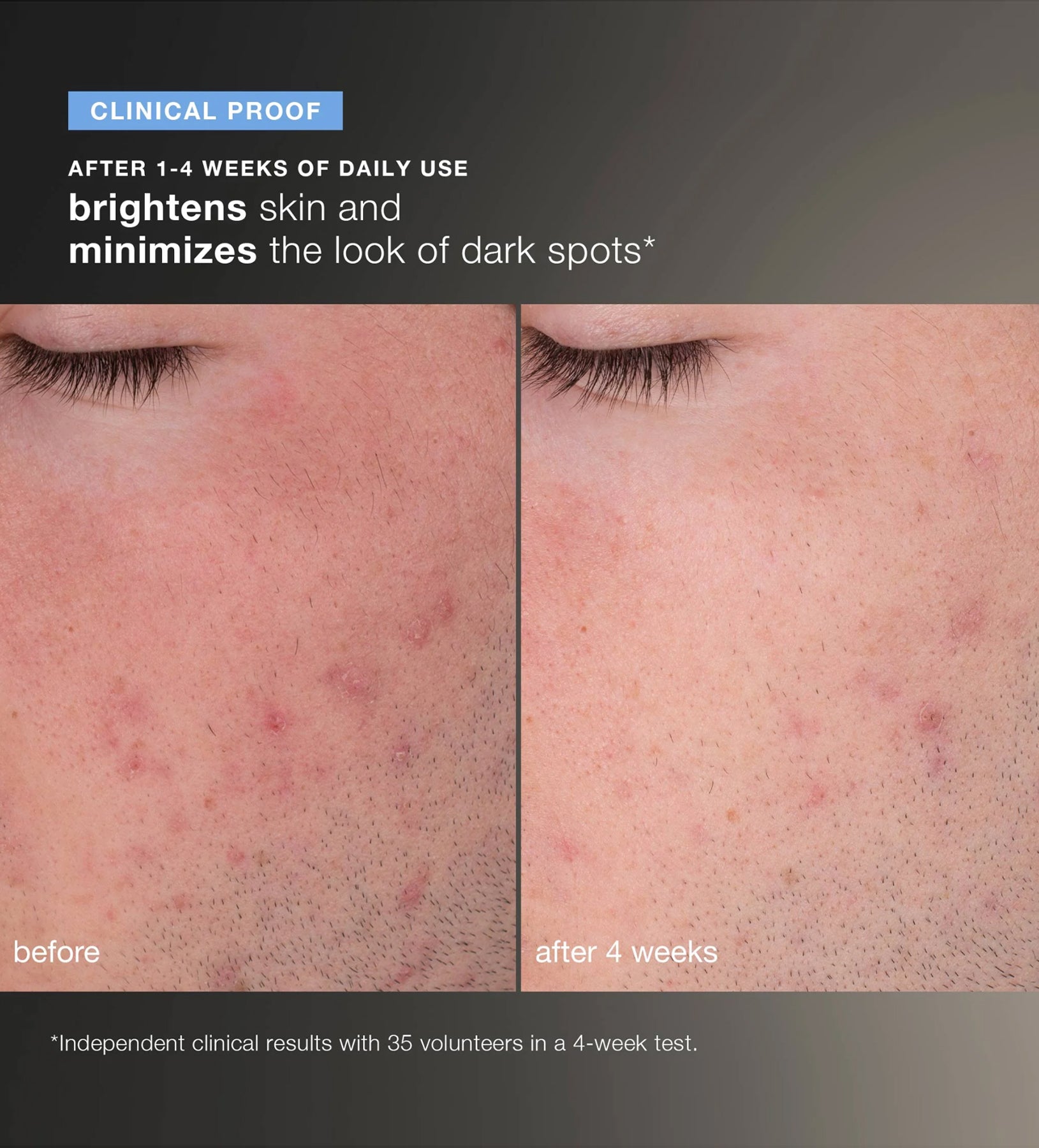 דיילי מיקרופוליאנט