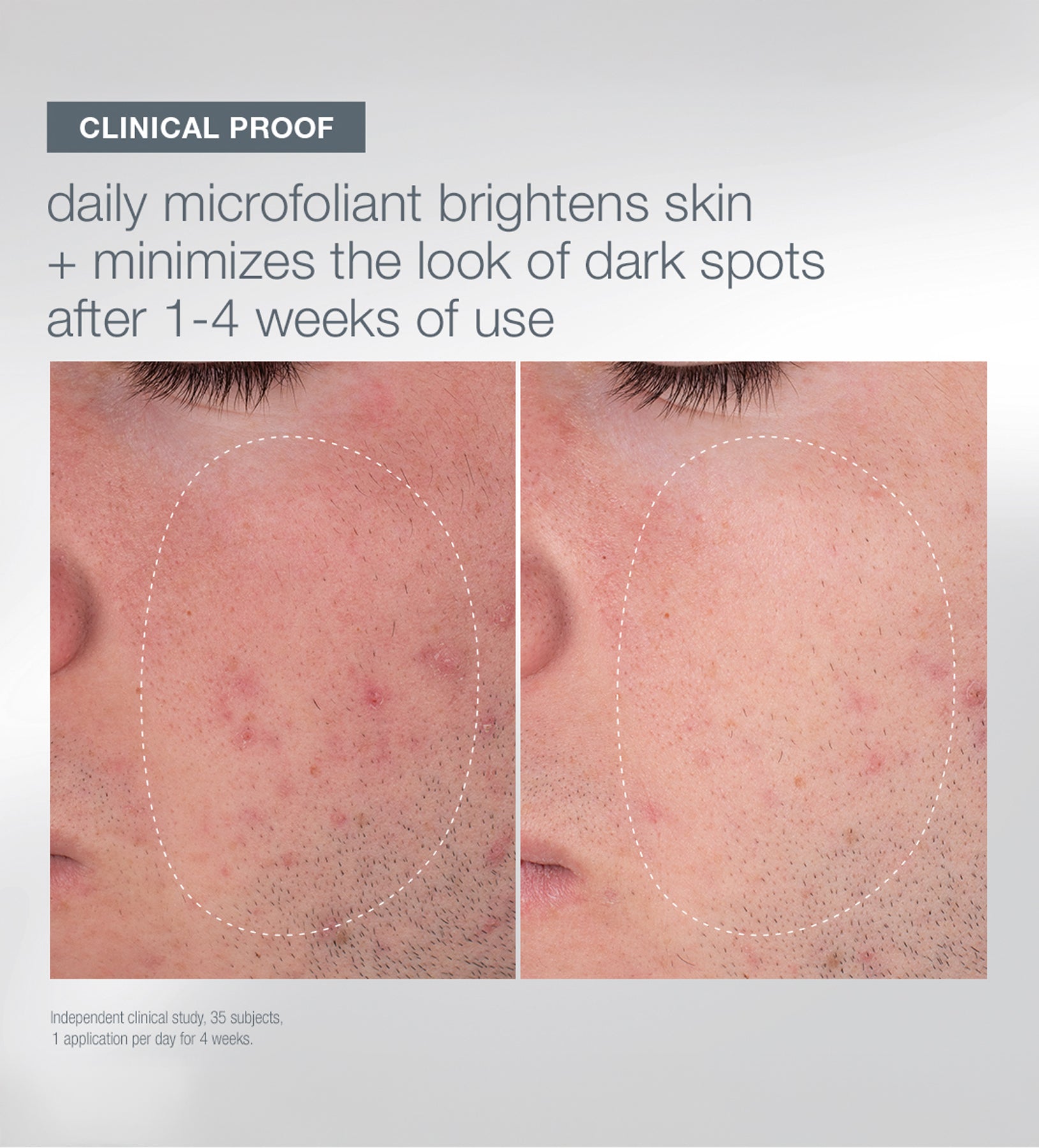 פילינג אורז במהדורה חד פעמית!