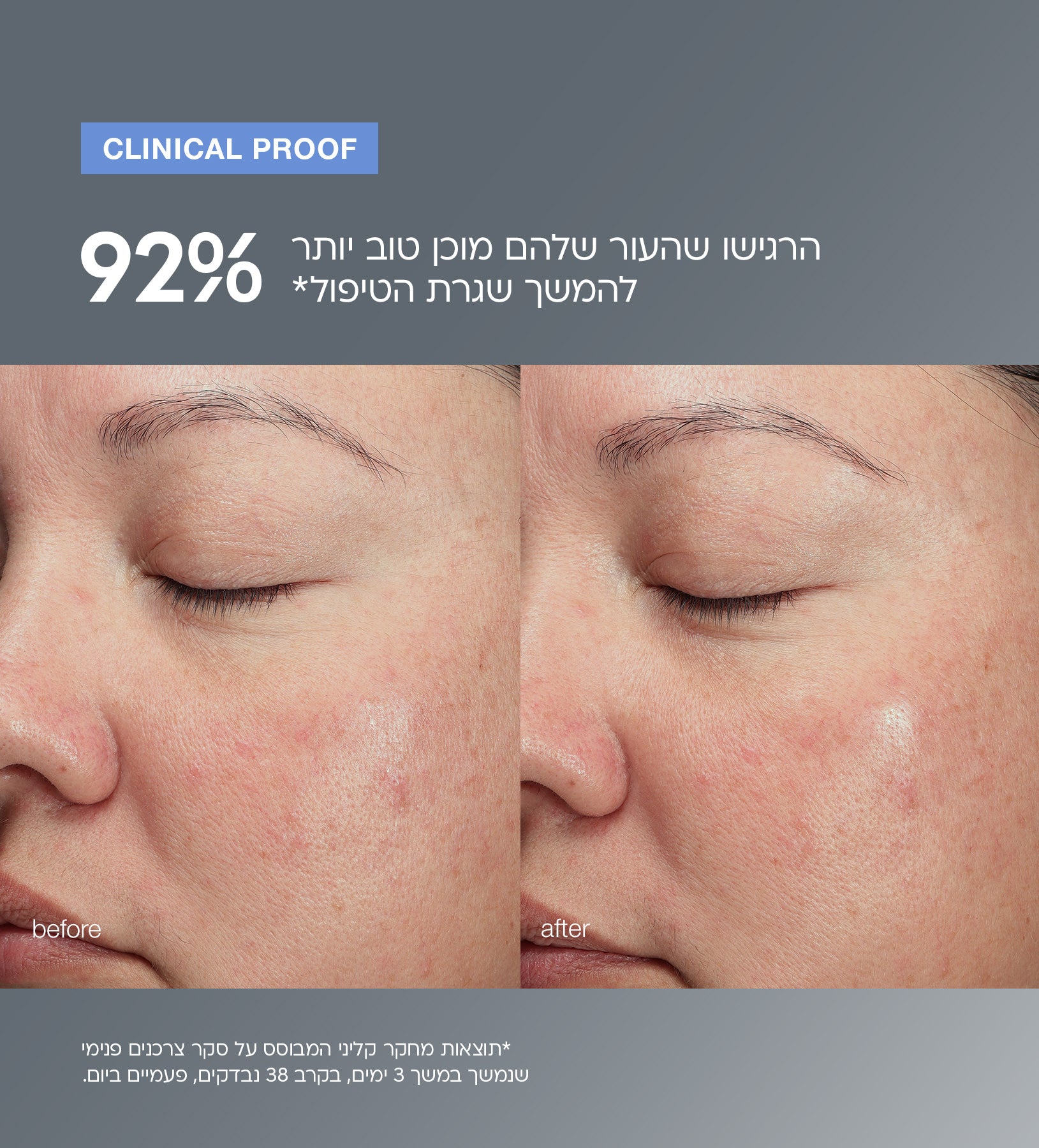 מגנטיק אפטר גלואו קלינסר