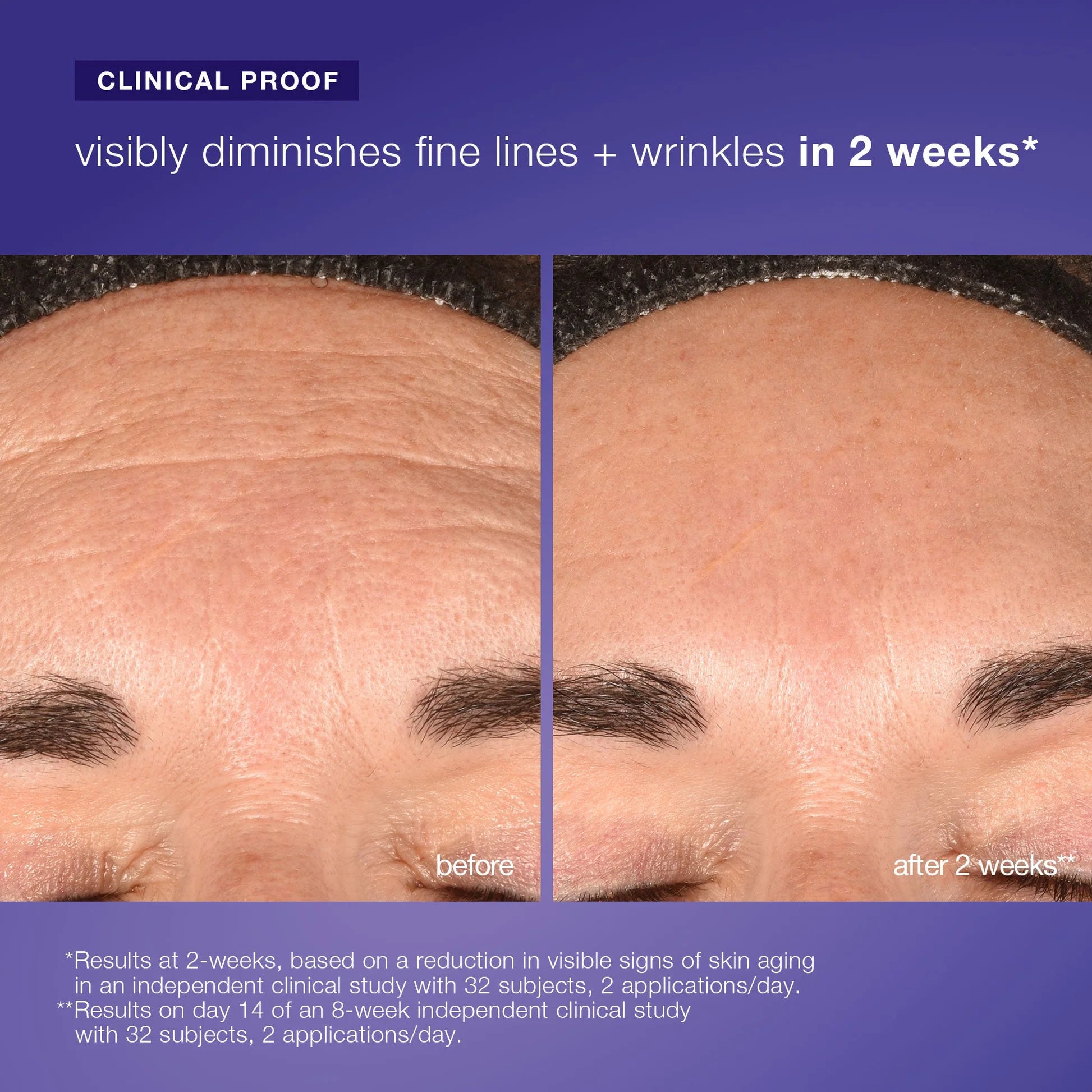 פיטו נייטשר e² אקסוזום רגנרטיבי לשימוש יומיומי