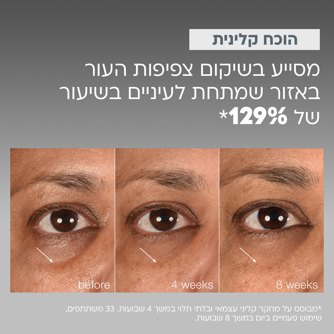 סמארט איי דנסיטי
